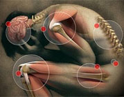 Tratamento de Dor em Lajeado